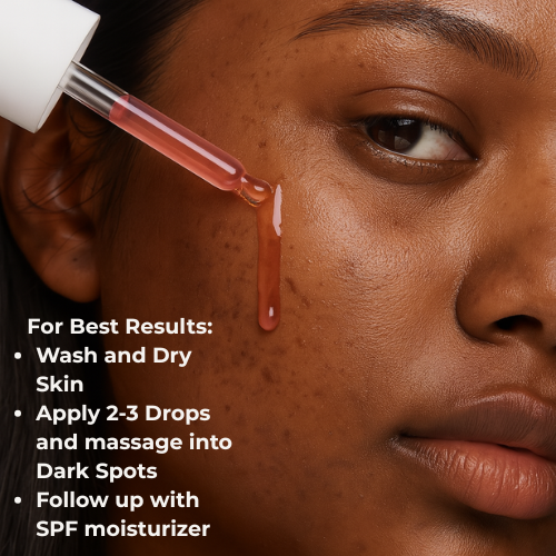 Mystiqua's RedNova™ Dark Spot Remover